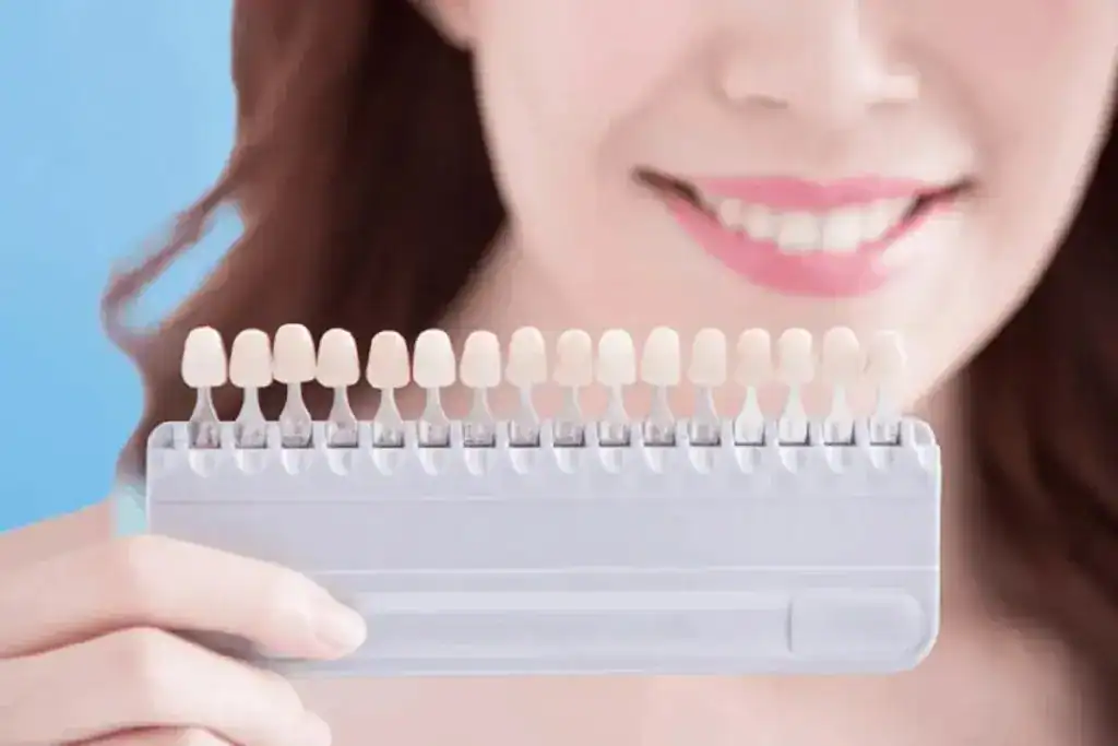 Is It Safe to Whiten a Tooth That’s Had a Lot of Dental Work Already Oxfordshire